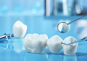 A dental bridge is a dental prosthetic that replaces multiple missing teeth in Lincoln, NE